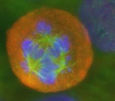Aktuelle Forschung: Krebszellen sind auf Spannung angewiesen
